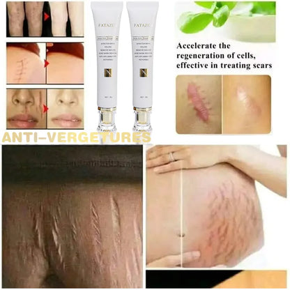 FATAZEN Herbal Effective Skin Repairing Gel Natural Acne Pimple Mark Stretch Marks Scar Removing Cream